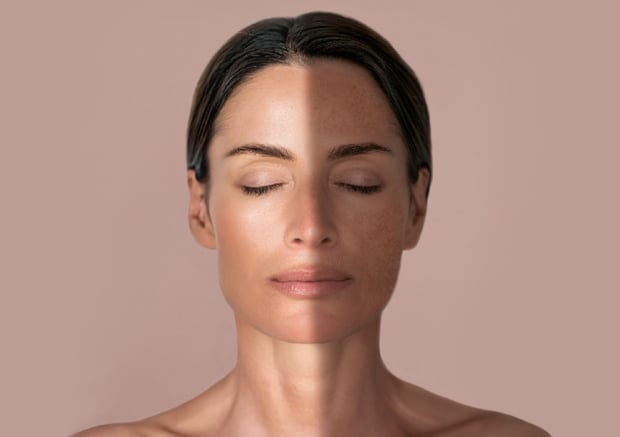 αντιγήρανση